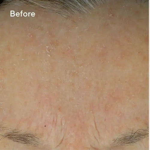 Daily Defense Cream results before application