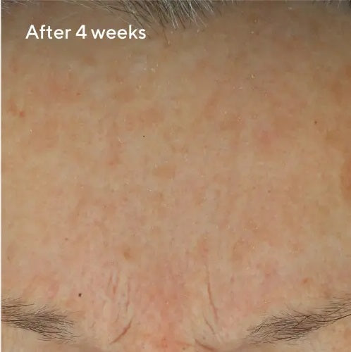 Daily Defense Cream Results After 4 Weeks