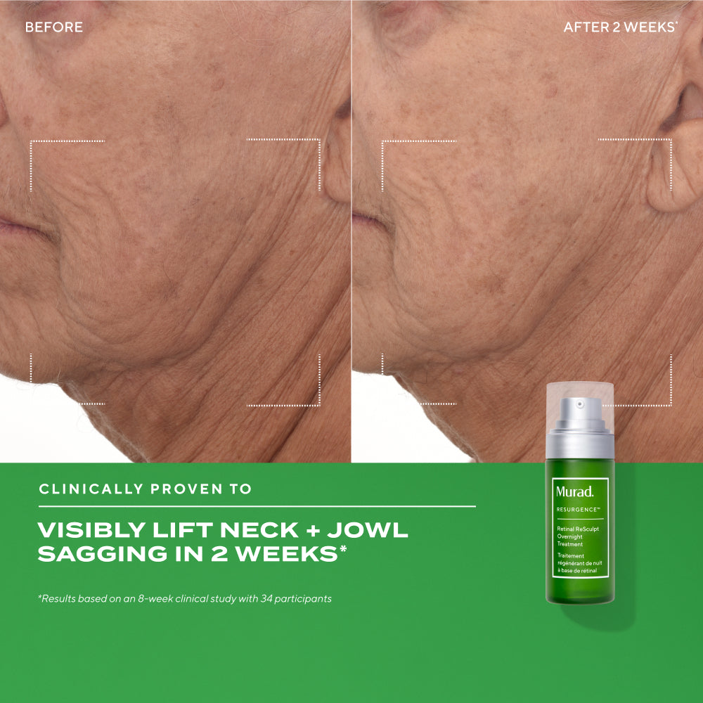 Retinal ReSculpt™ Overnight Treatment