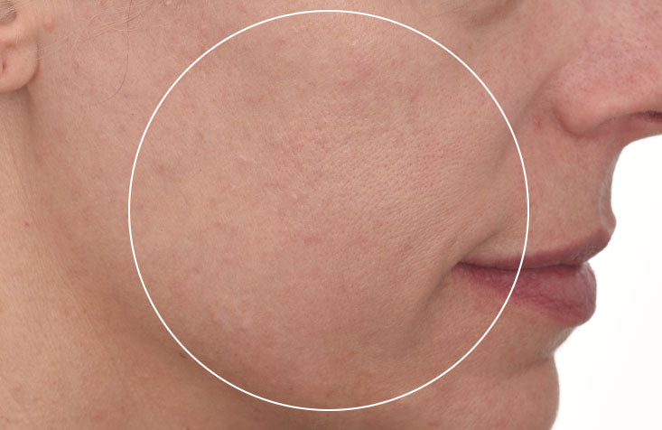 Cellular Hydration Barrier Repair Cream results after