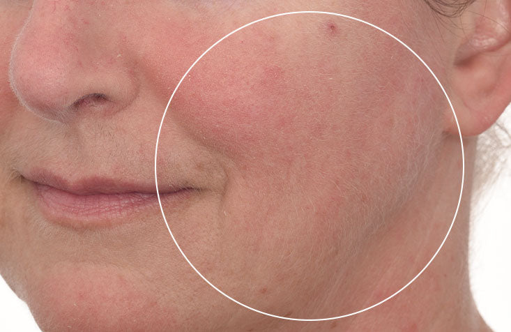 Cellular Hydration Barrier Repair Mask results after