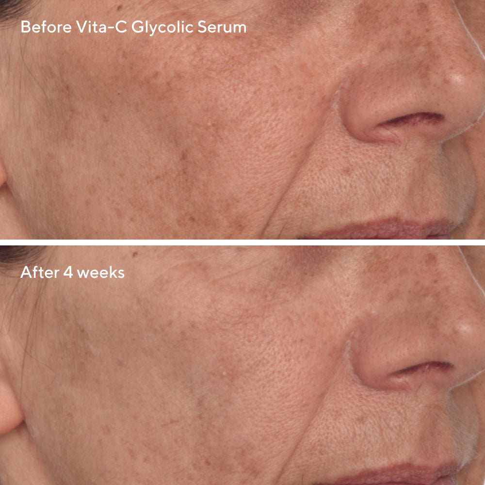 Radiant Skin Discovery Kit