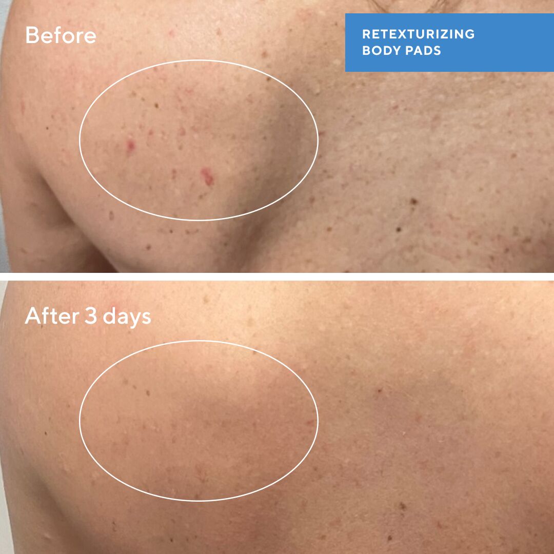 Retexturising Body + Face Pads