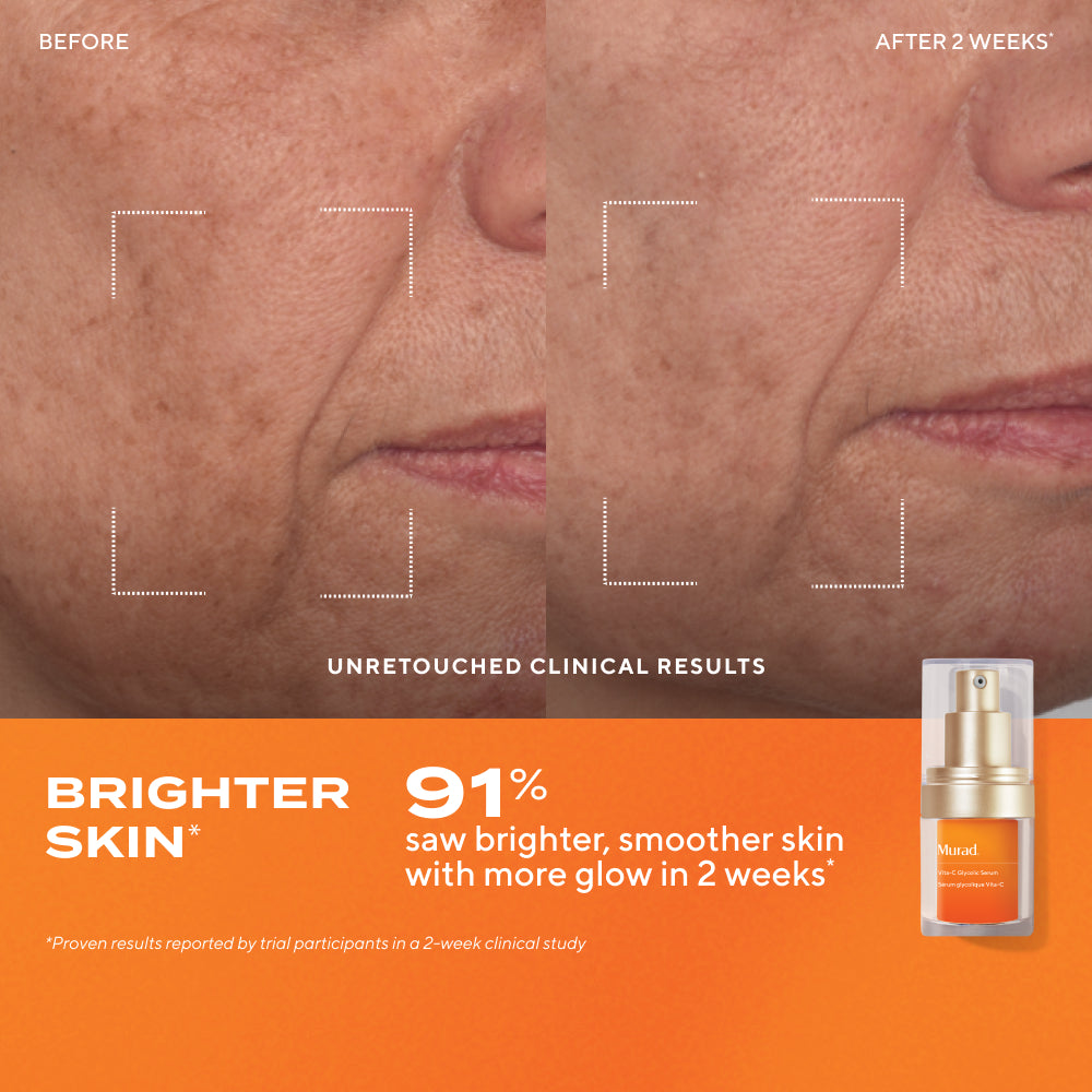 The Radiant Skin Ritual Gift Set