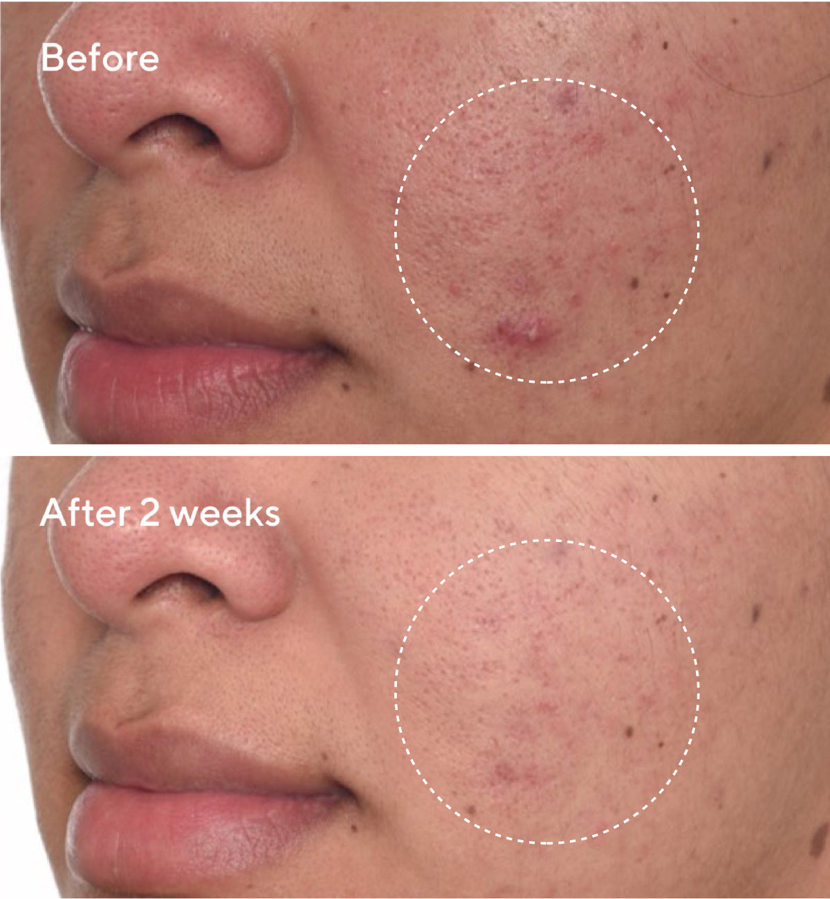 Rapid Dark Spot Correcting Serum