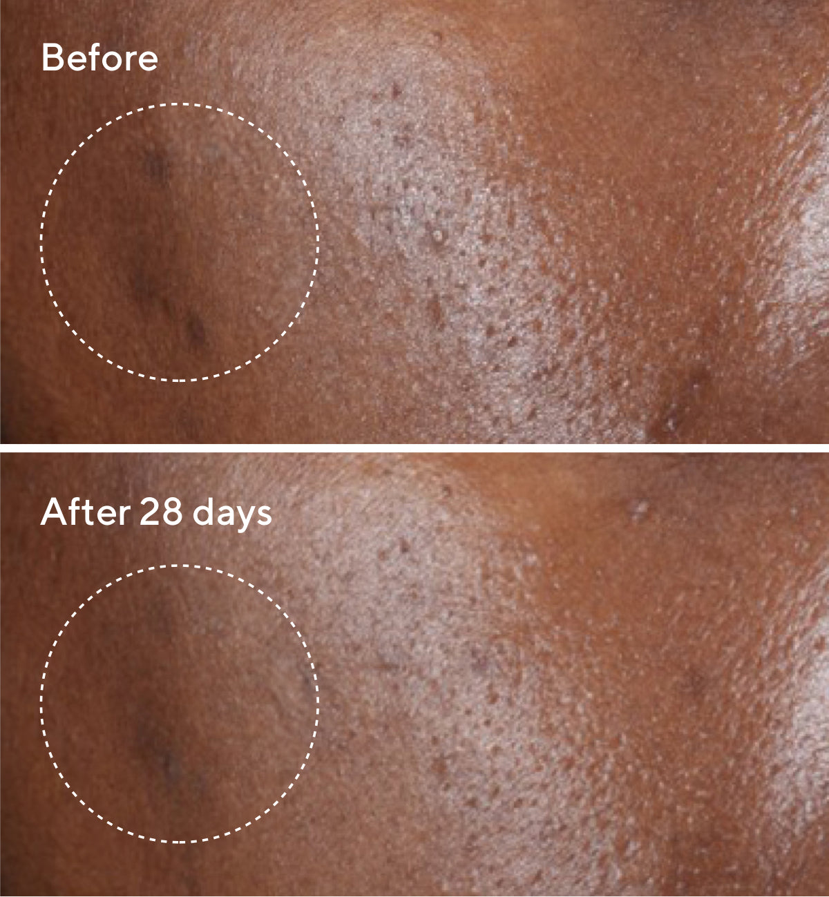 Rapid Dark Spot Correcting Serum