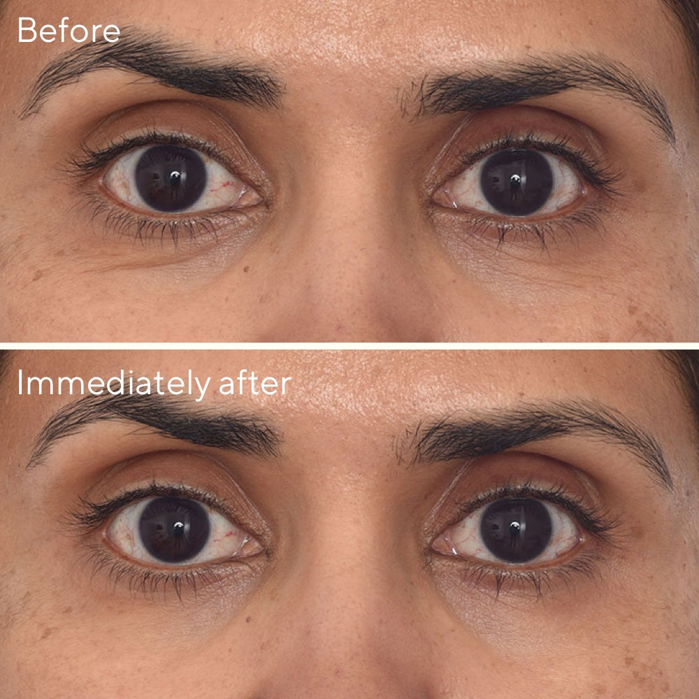 Retinol Youth Renewal  Eye Masks