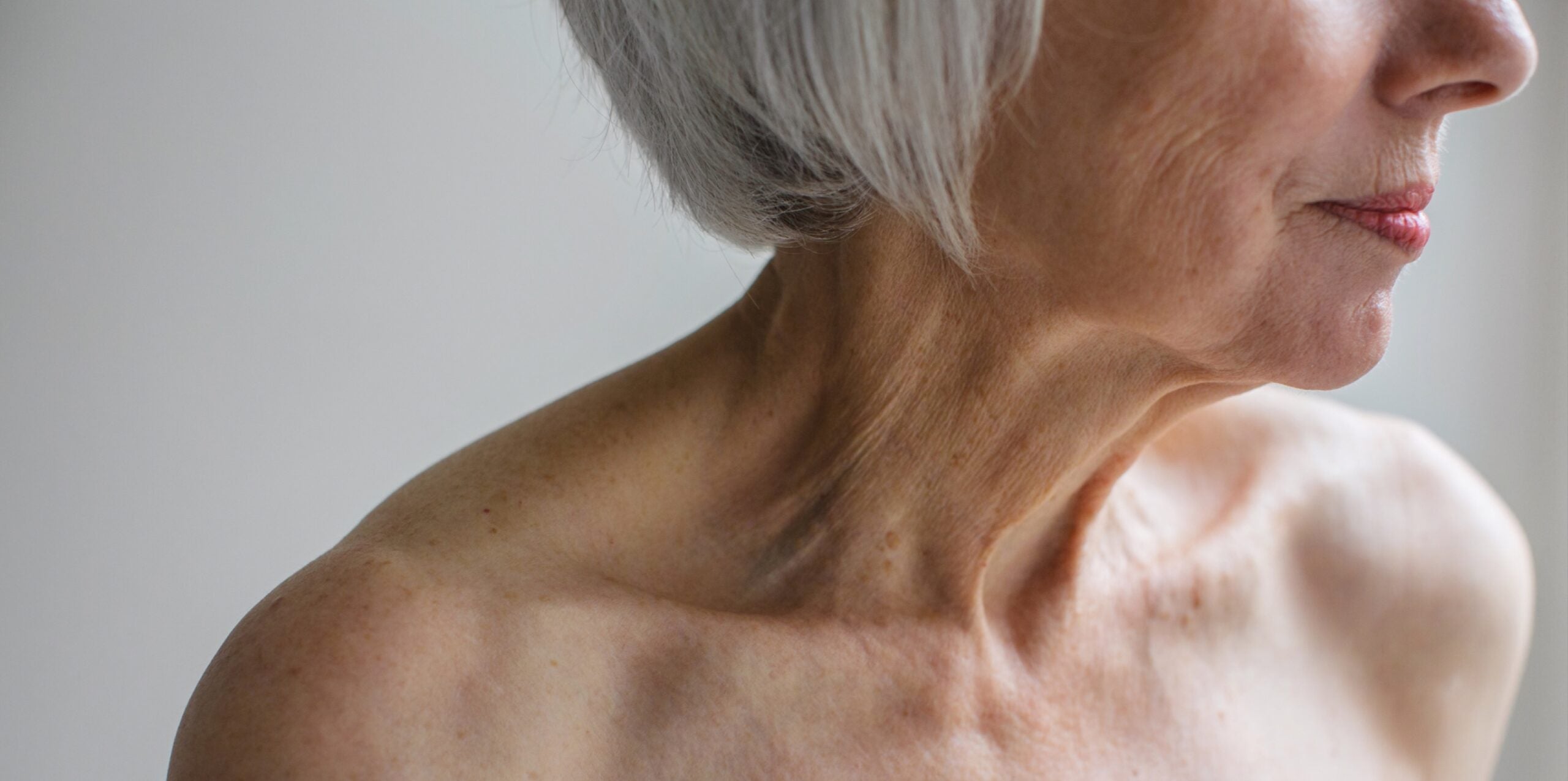 Wrinkle wrap-up, part 4: It’s time to talk neck wrinkles, from neck lifts to tech neck