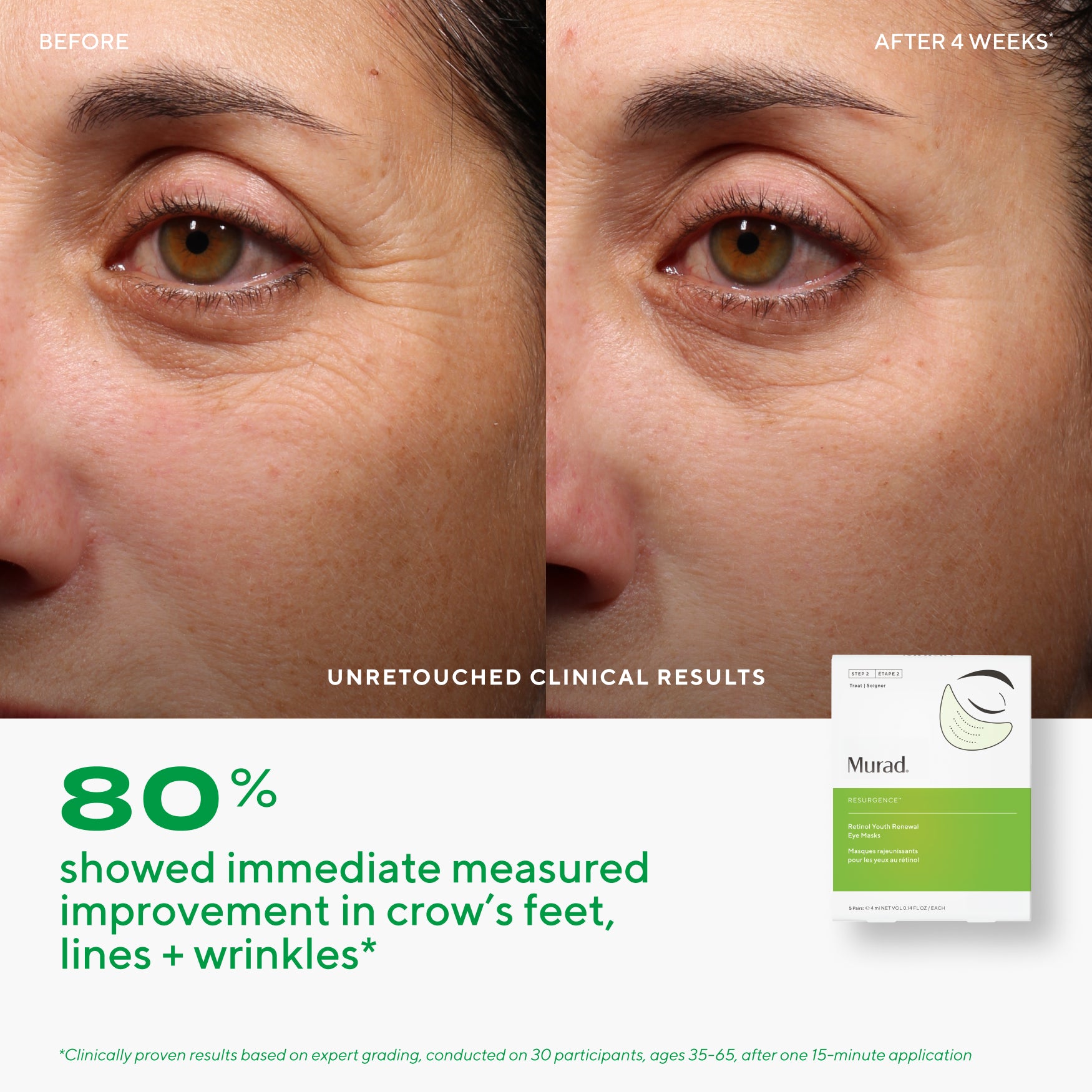 Retinol Youth Renewal  Eye Mask - Single Pack Gift
