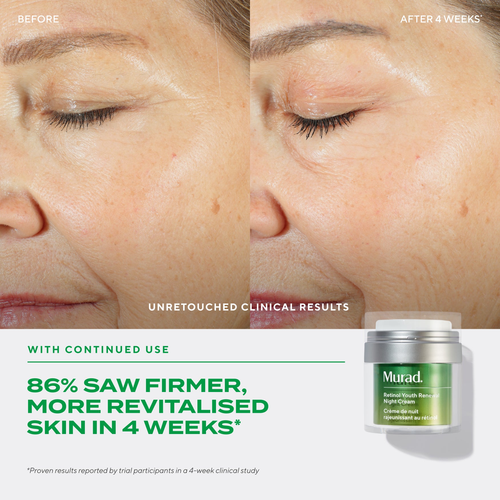 Retinol Youth Renewal Night Cream