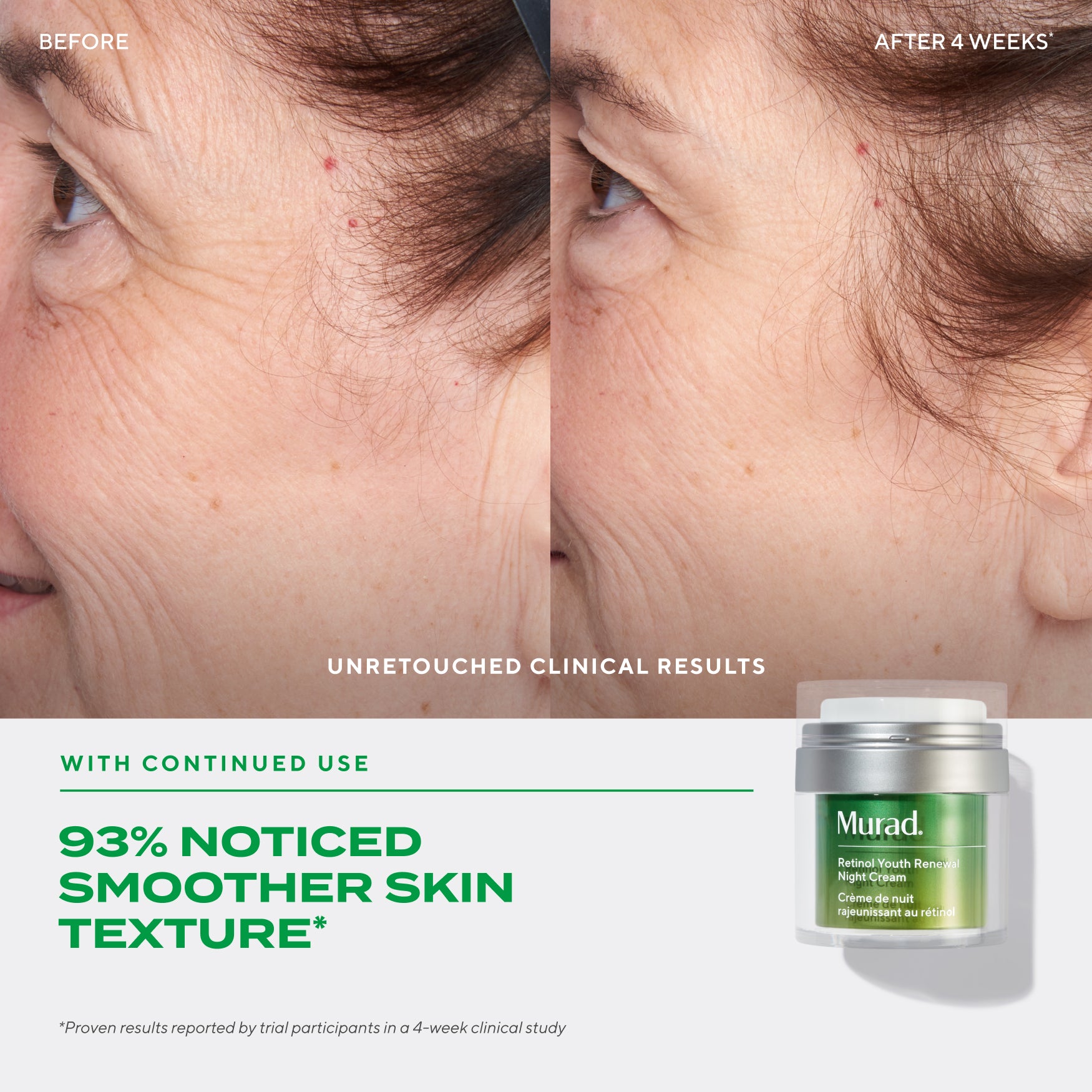 Retinol Youth Renewal Night Cream