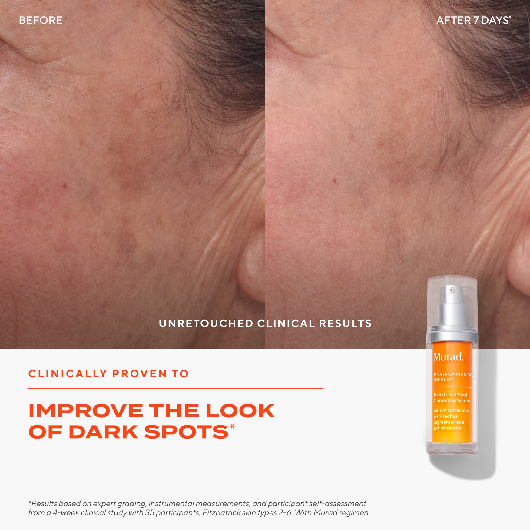 Dark Spot Clearing Duo