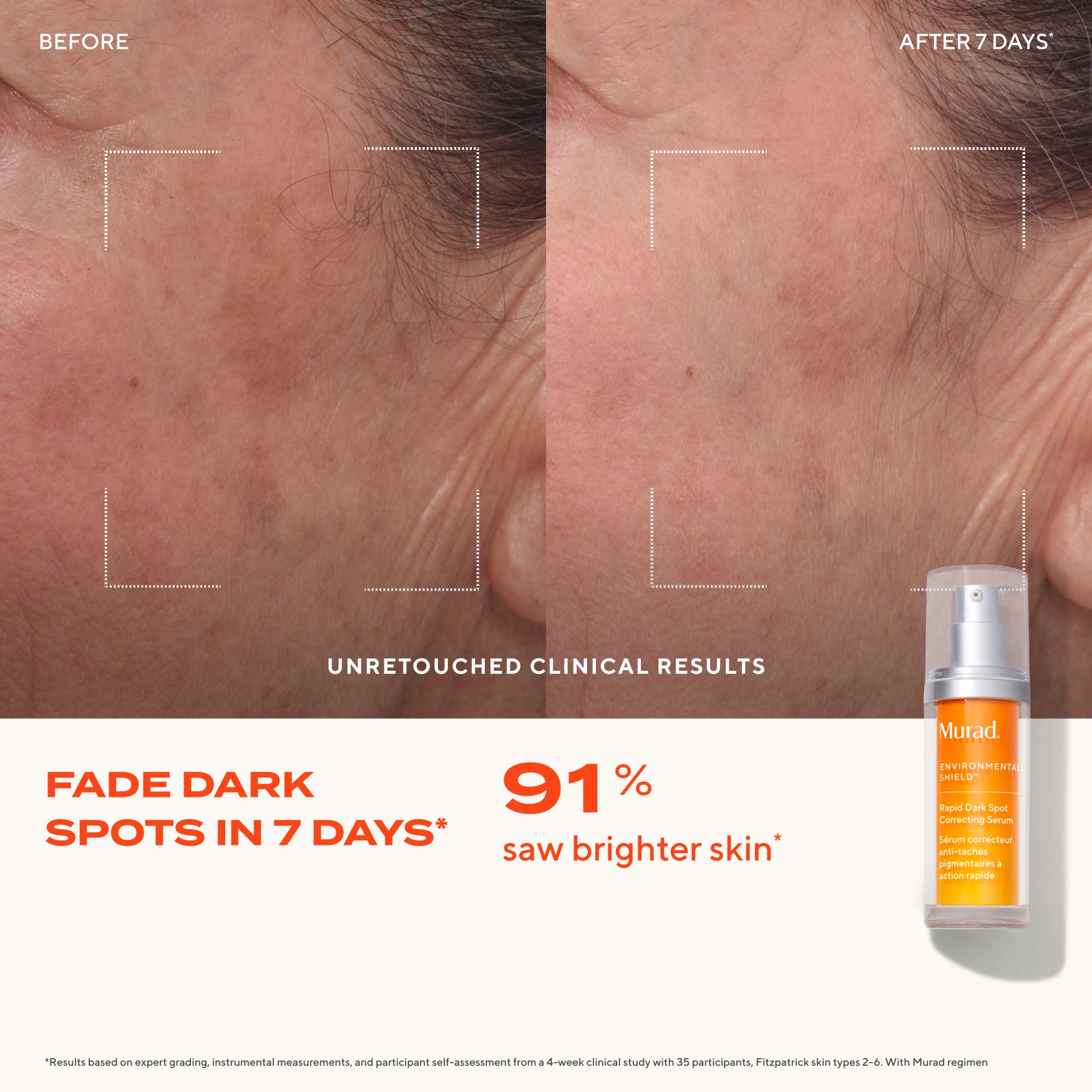 Rapid Dark Spot Correcting Serum