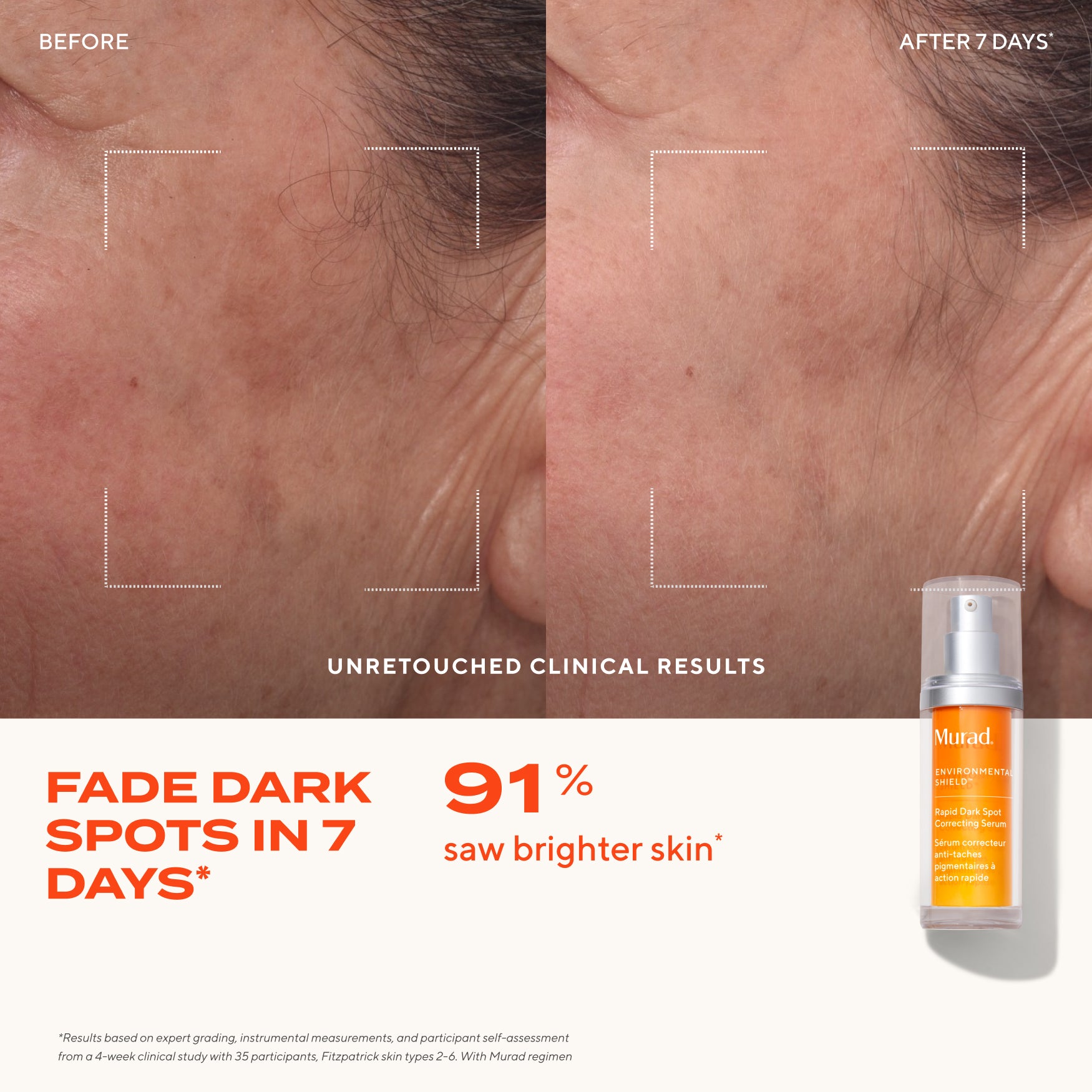 Dark Spot Clearing Duo