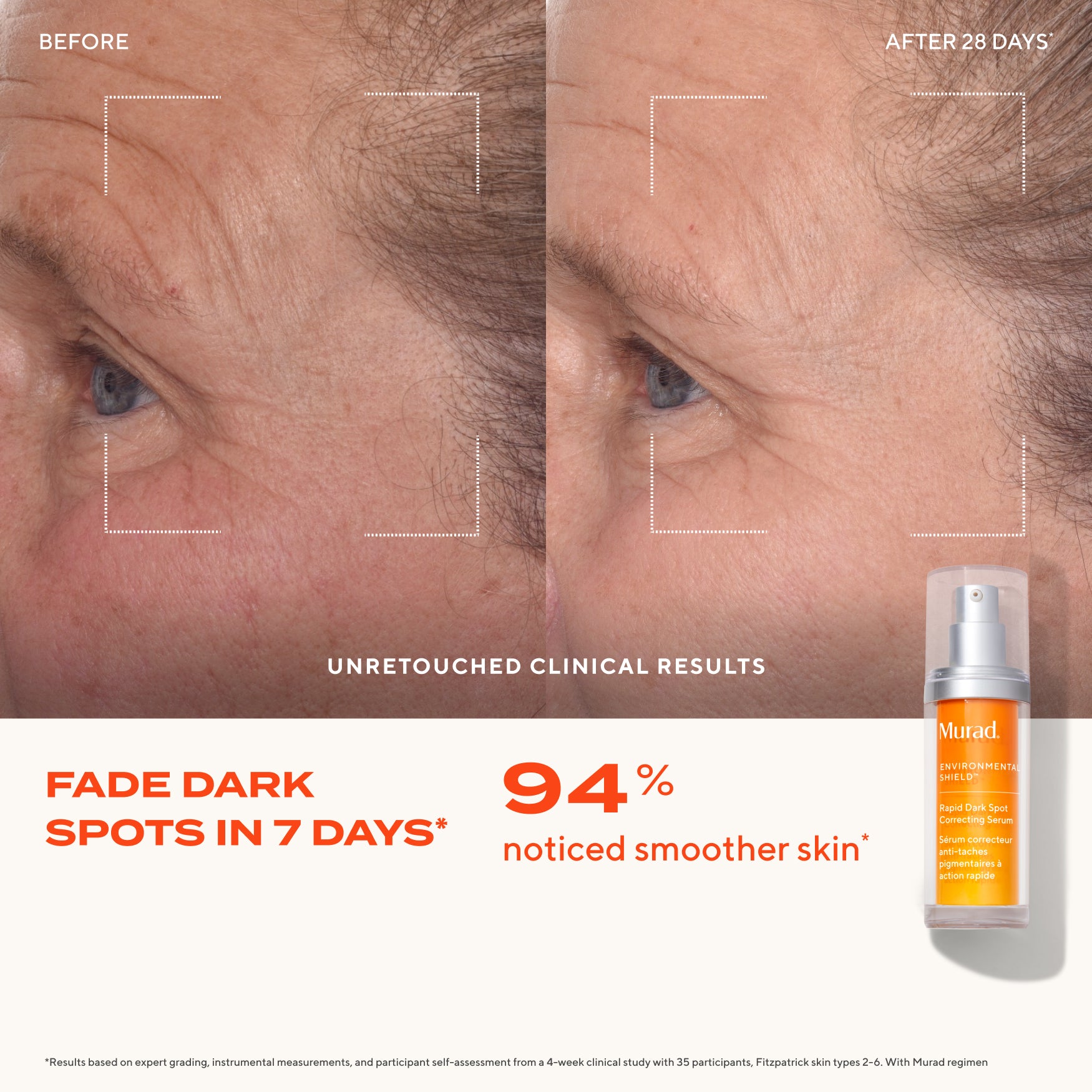 Rapid Dark Spot Correcting Serum