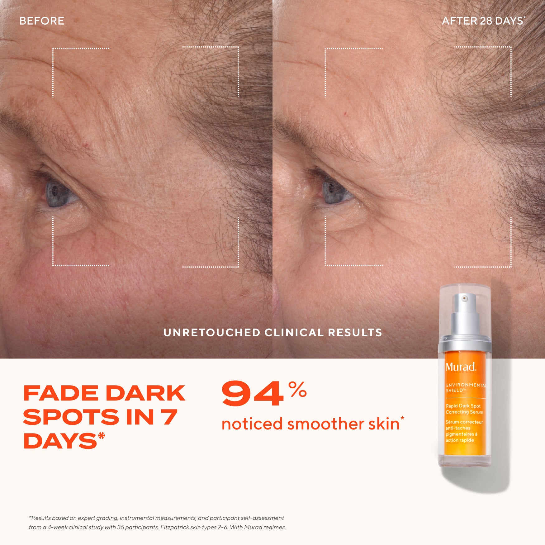 Dark Spot Clearing Duo