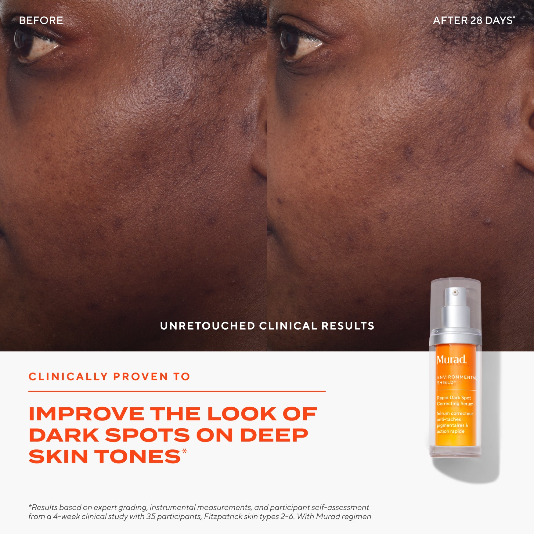 Dark Spot Clearing Duo