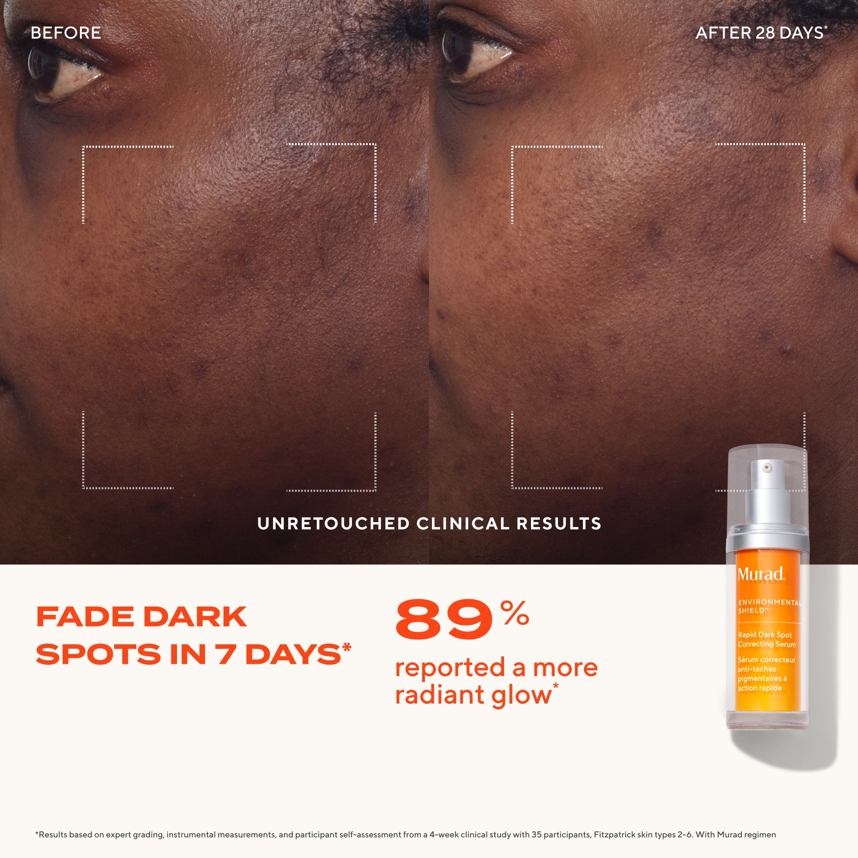 Rapid Dark Spot Correcting Serum