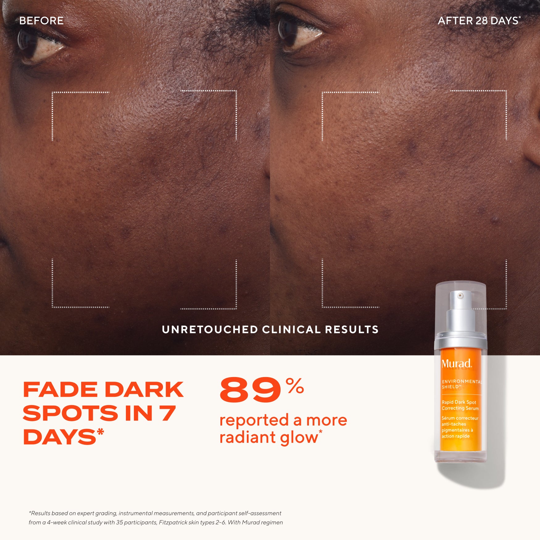 Dark Spot Clearing Duo