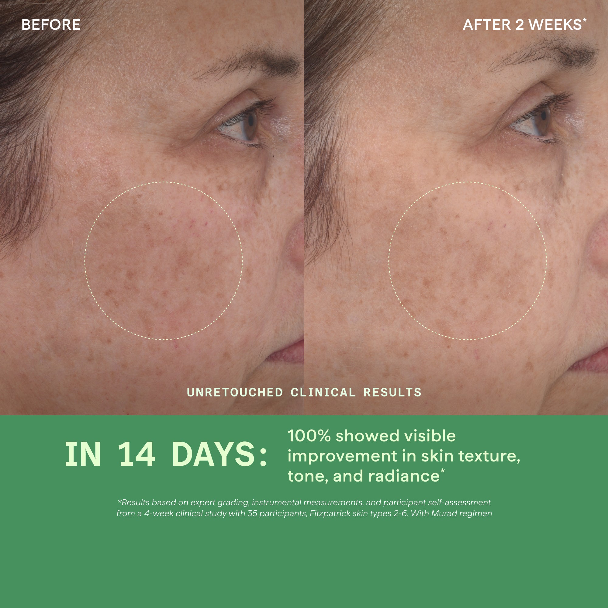 Retinol Youth Renewal Serum