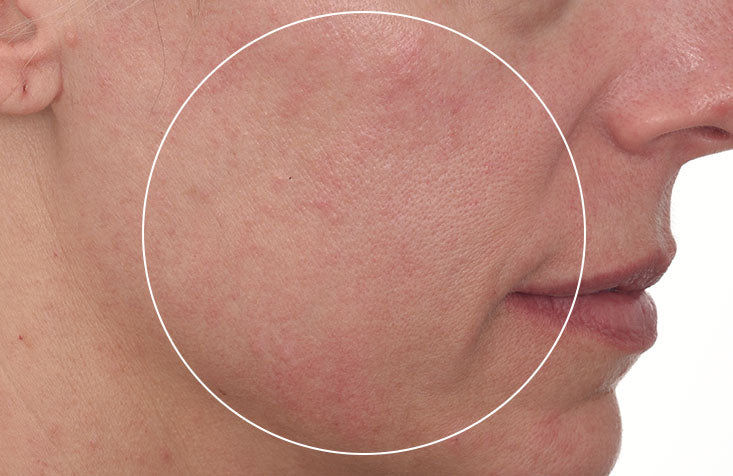 Cellular Hydration Barrier Repair Cream results before