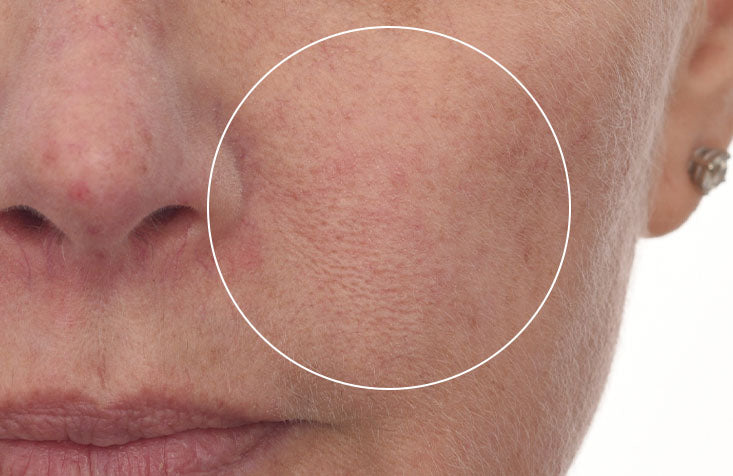 Cellular Hydration Barrier Repair Serumm After results