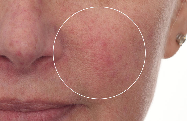 Cellular Hydration Barrier Repair Mask results before