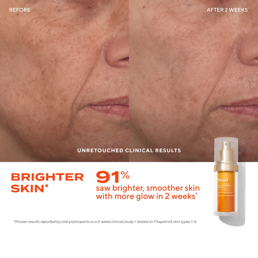 Vita-C Glycolic Serum Refill Bundle