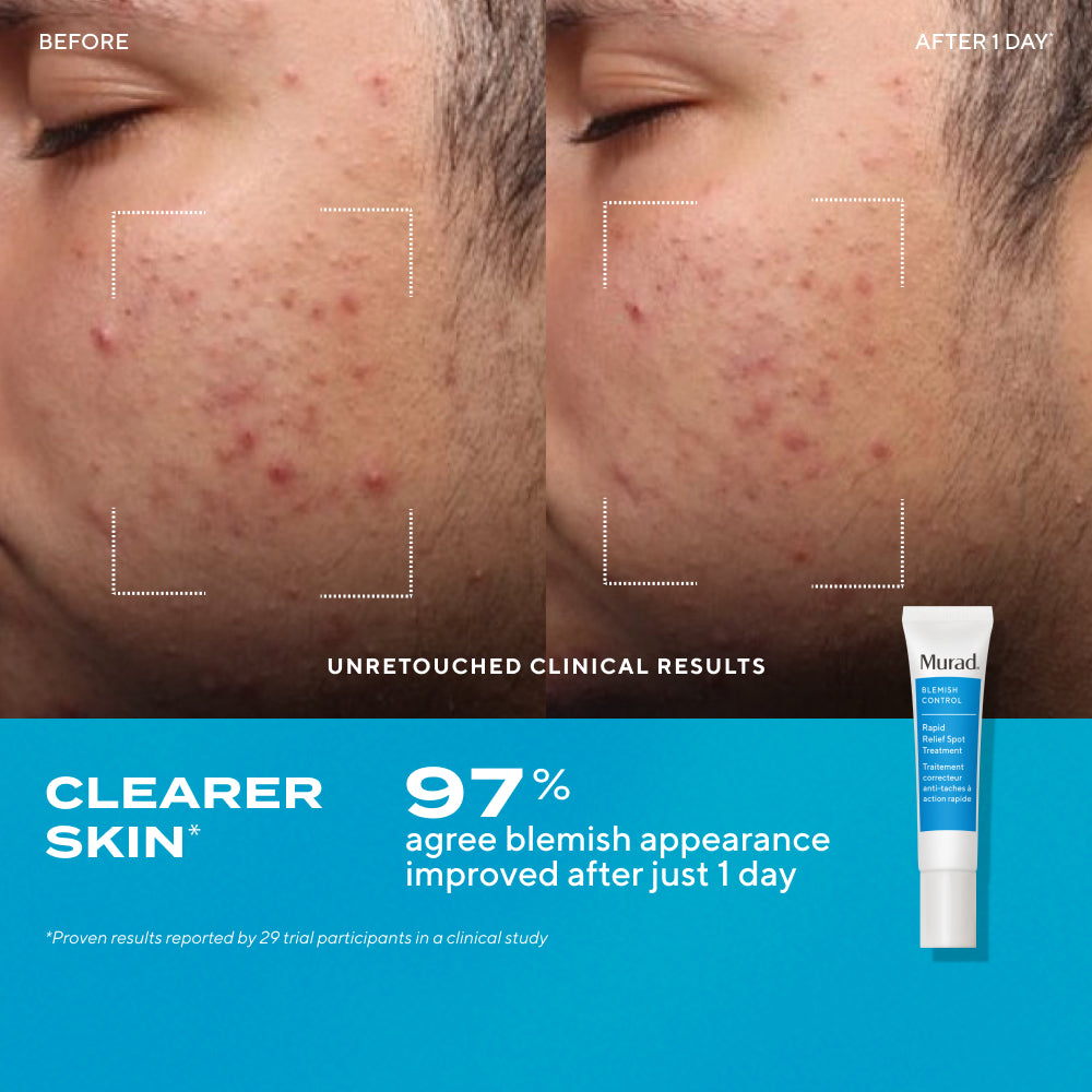 Blemish Control Kit
