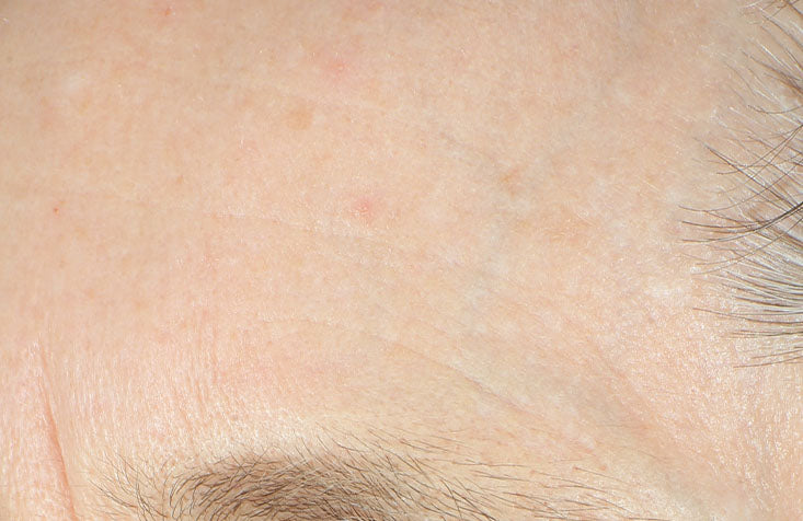 Instense Recovery Cream results after