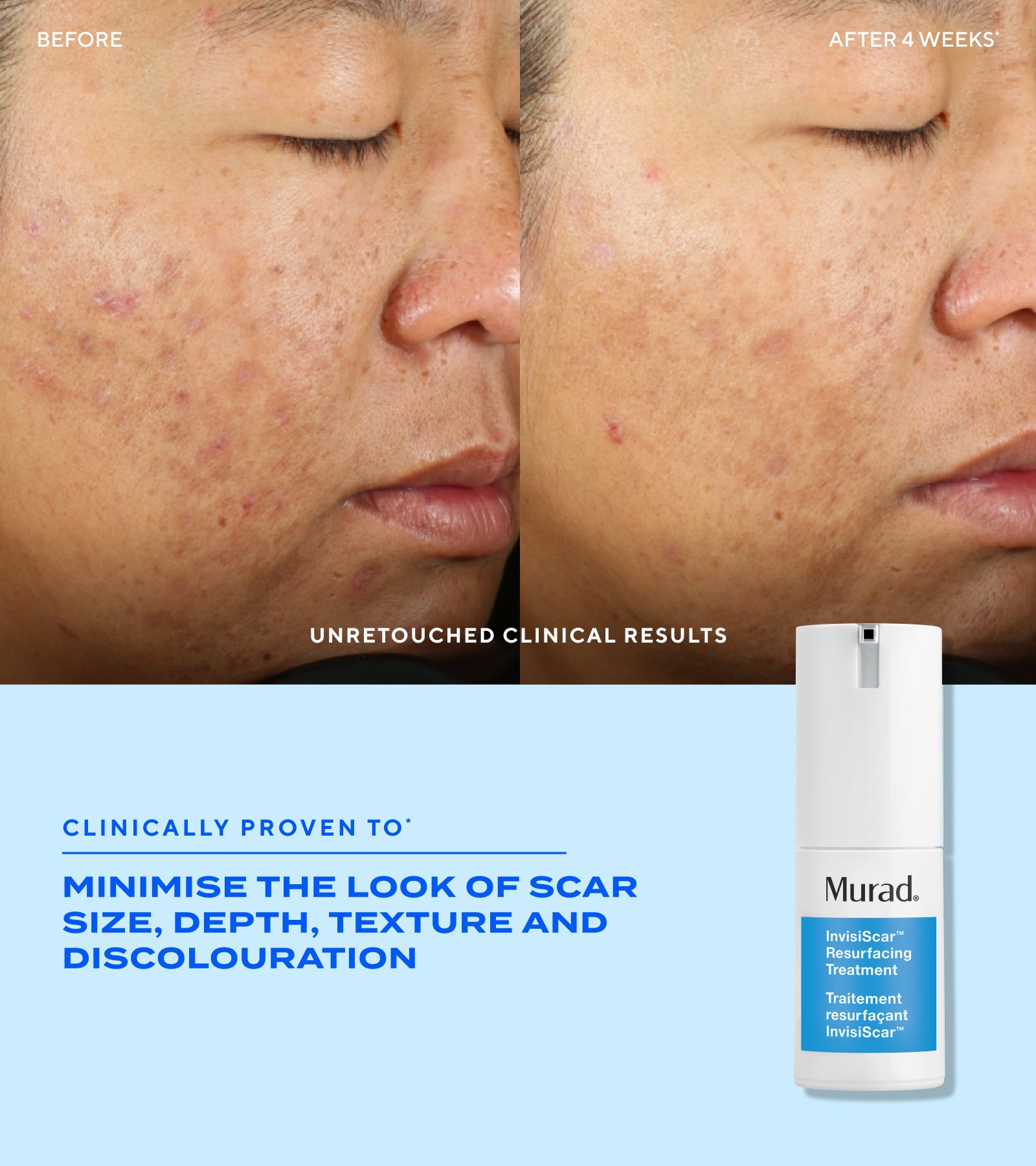 Complete Blemish Regimen