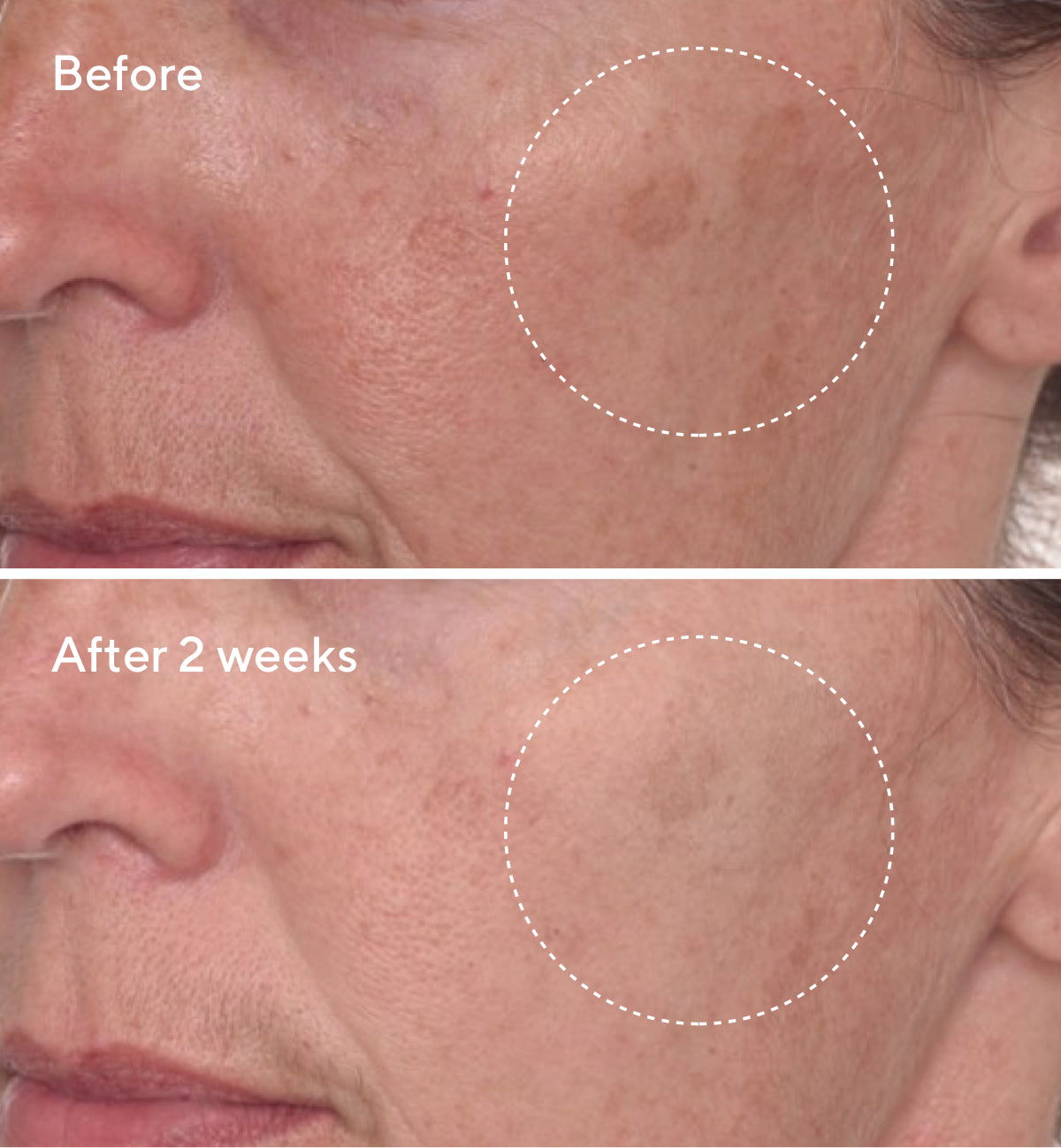 Rapid Dark Spot Correcting Serum