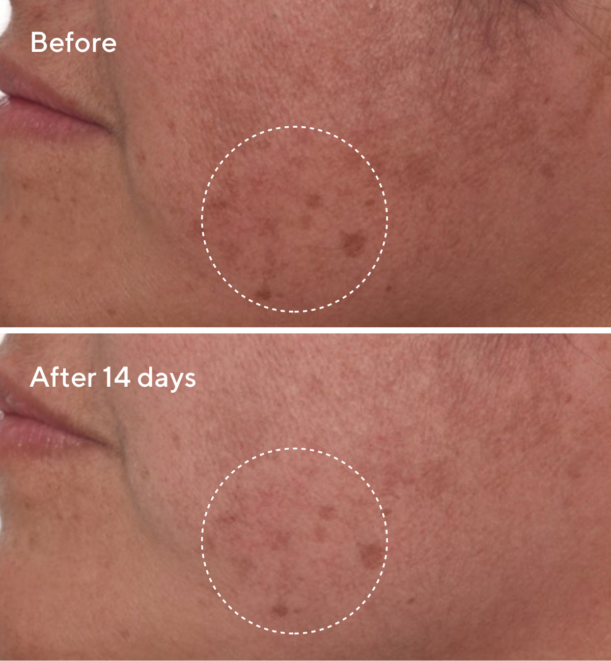 Rapid Dark Spot Correcting Serum