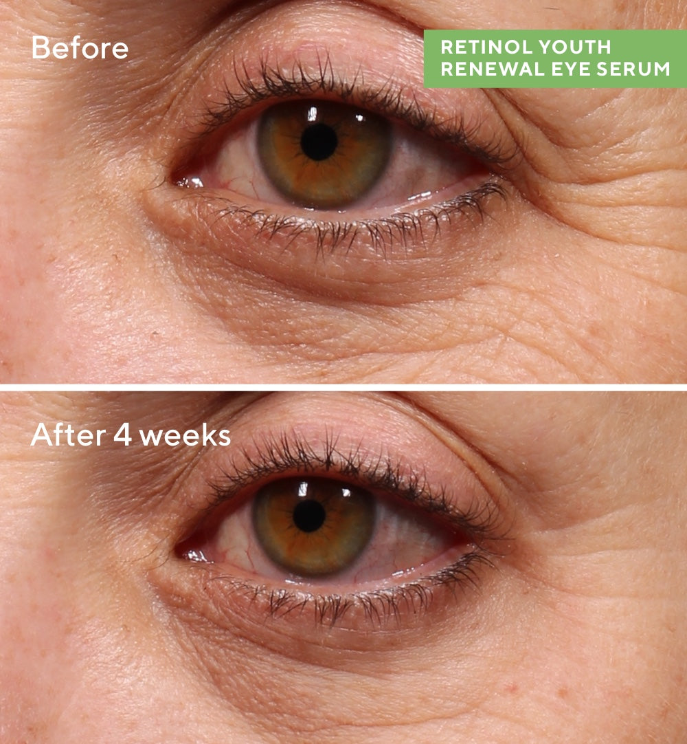 Rapid Wrinkle Repair