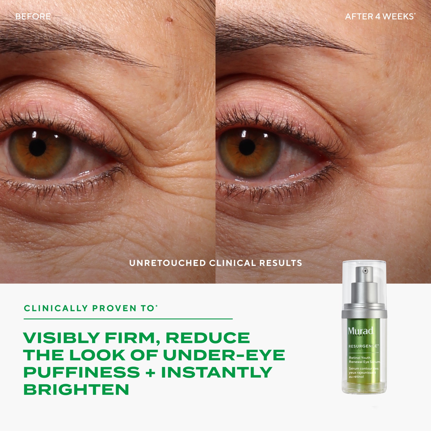 Retinol Youth Renewal Eye Serum