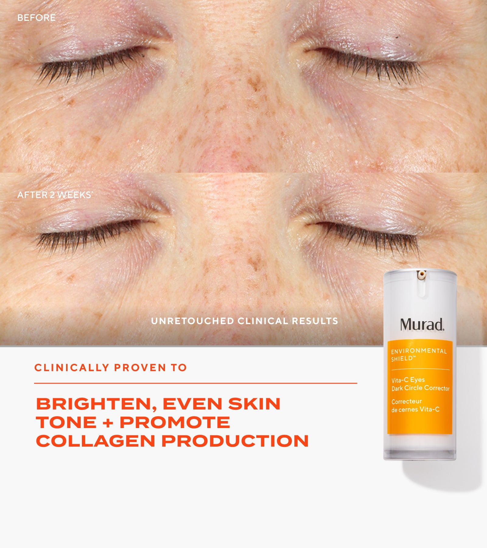 Advanced Brightening Regimen